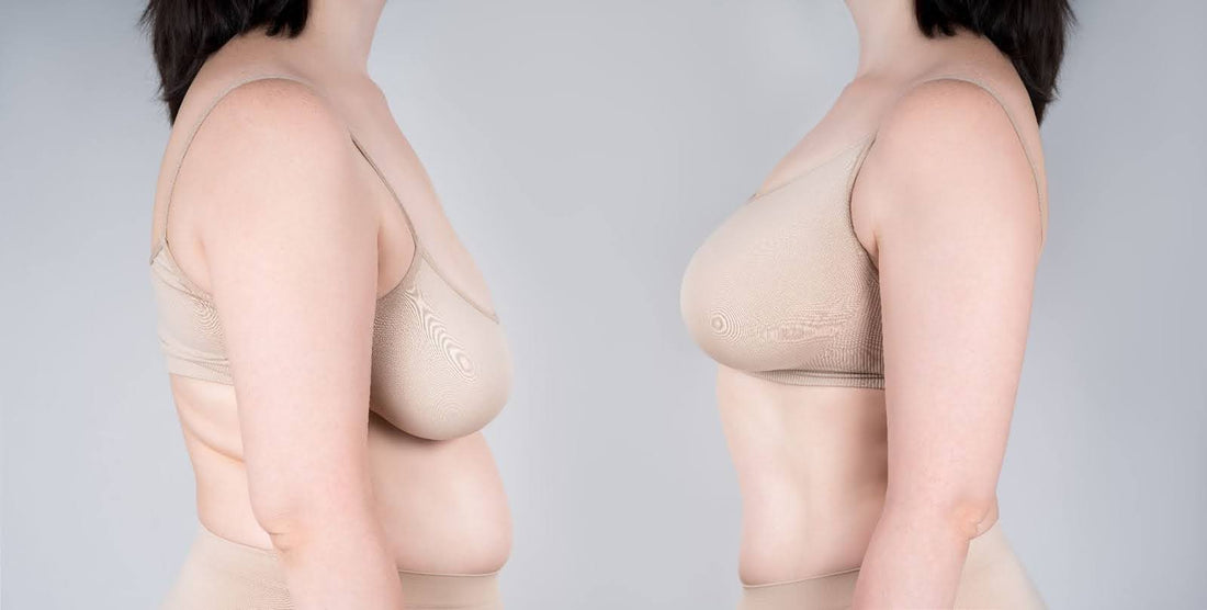Before and after effect of supportive bra for sagging breasts